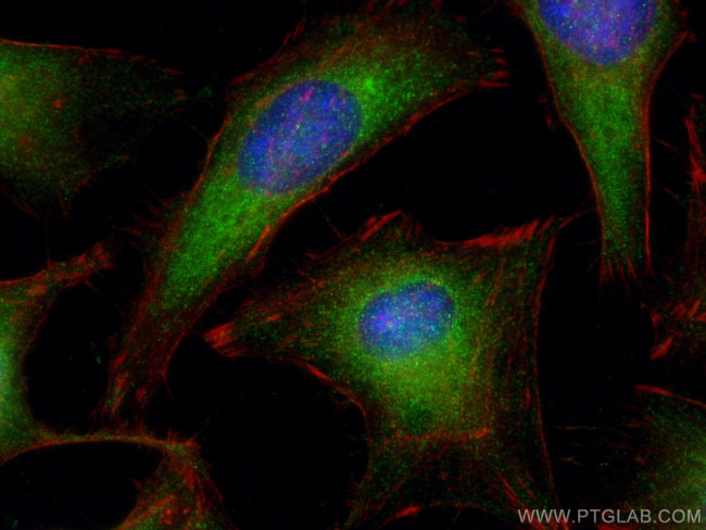 PKC alpha Antibody in Immunocytochemistry (ICC/IF)