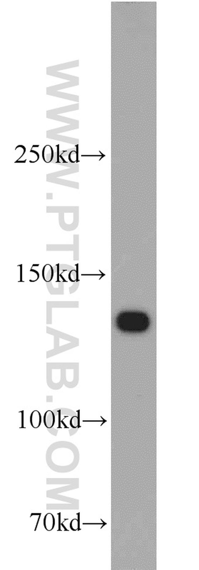 Integrin alpha-3 Antibody in Western Blot (WB)