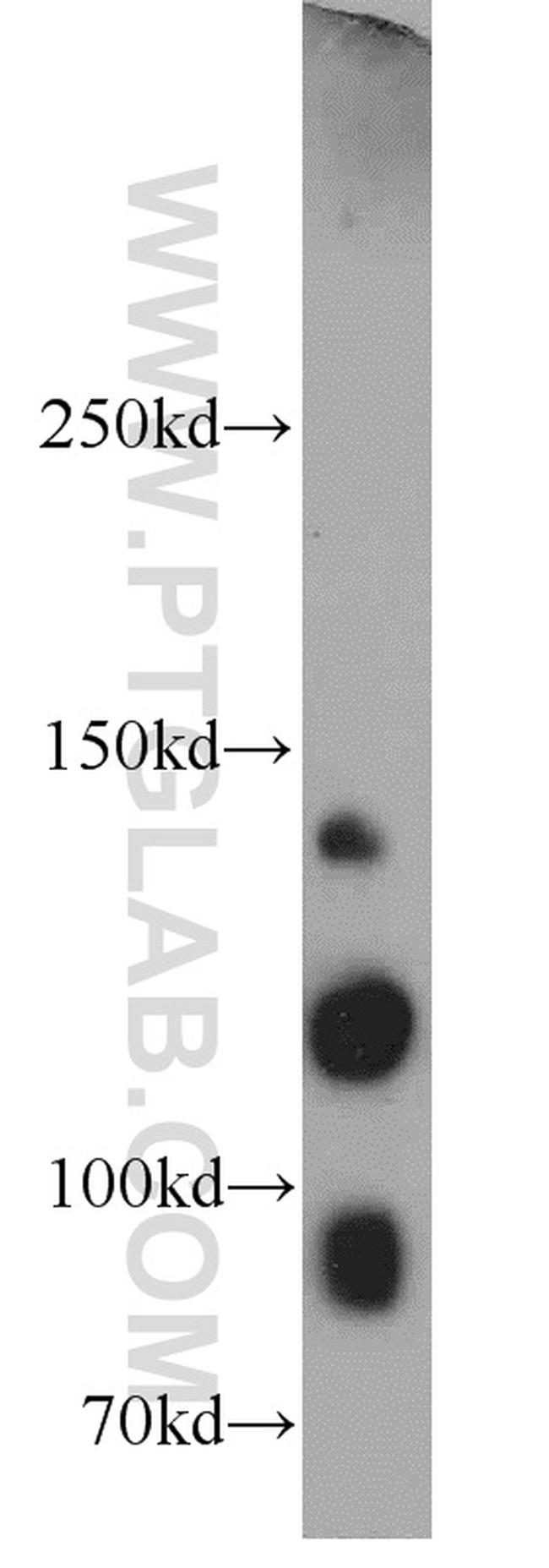 Integrin alpha-3 Antibody in Western Blot (WB)