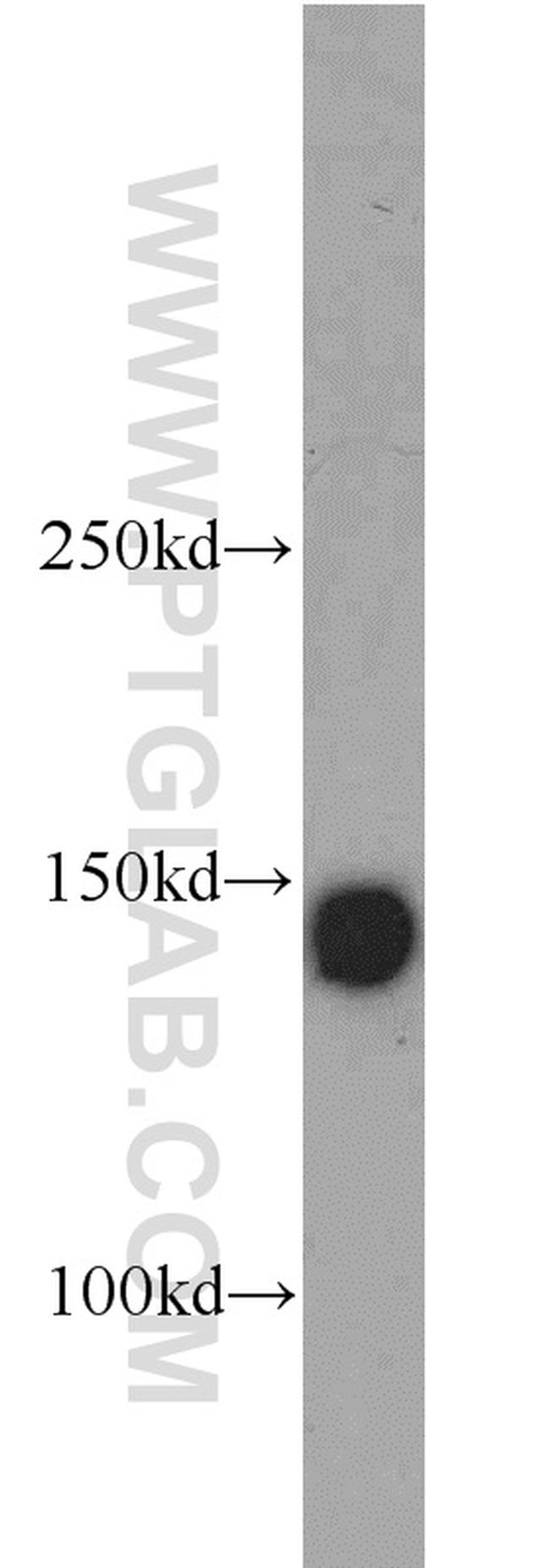 Integrin alpha-3 Antibody in Western Blot (WB)