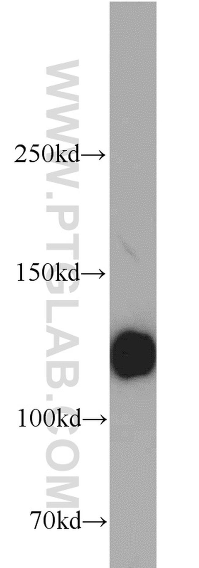 Integrin alpha-3 Antibody in Western Blot (WB)