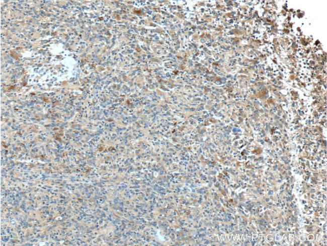 LAMP1 Antibody in Immunohistochemistry (Paraffin) (IHC (P))