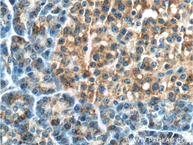 LAMP1 Antibody in Immunohistochemistry (Paraffin) (IHC (P))