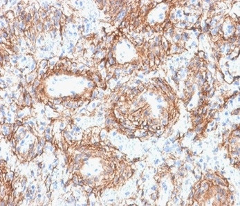 Fibrillin-1 (FBN1) (Marfan Syndrome Marker) Antibody in Immunohistochemistry (Paraffin) (IHC (P))