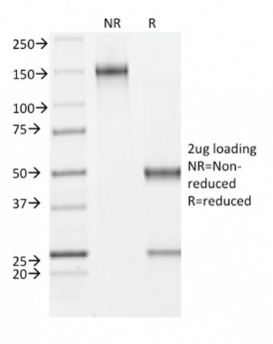 Fibrillin-1 (FBN1) (Marfan Syndrome Marker) Antibody in SDS-PAGE (SDS-PAGE)