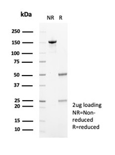 Fibrillin-1 (FBN1) (Marfan Syndrome Marker) Antibody in SDS-PAGE (SDS-PAGE)