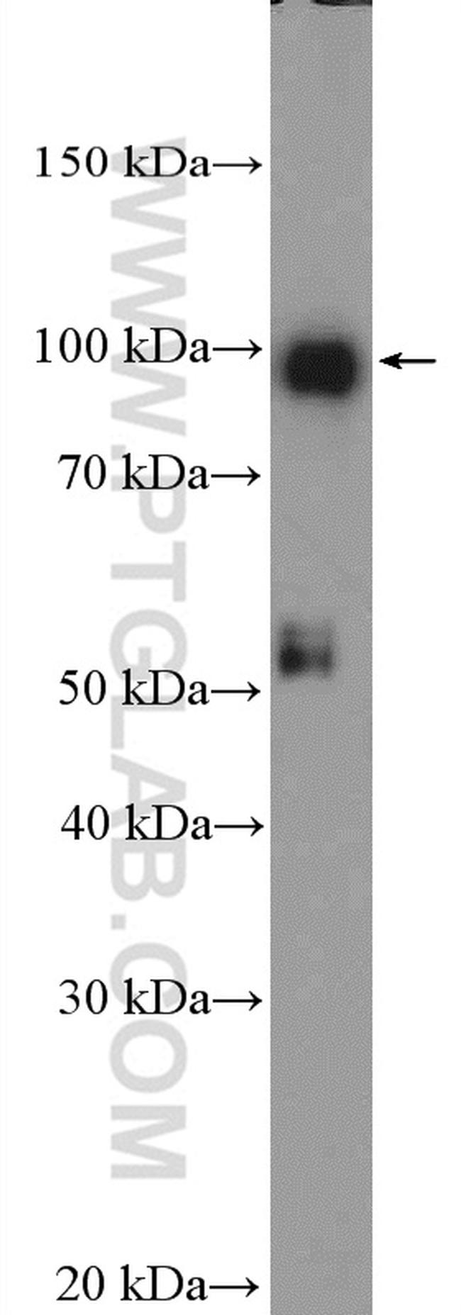 STRA6 Antibody in Western Blot (WB)