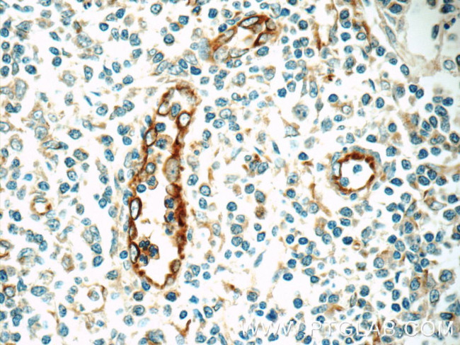 CLEC4M Antibody in Immunohistochemistry (Paraffin) (IHC (P))