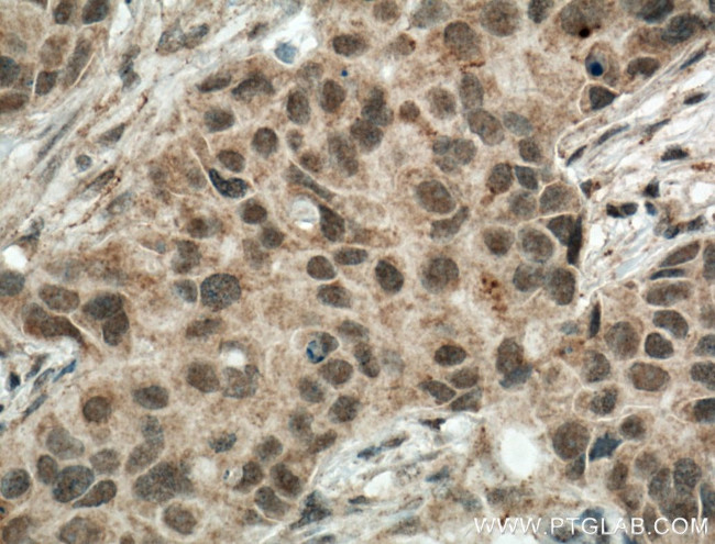 TBP Antibody in Immunohistochemistry (Paraffin) (IHC (P))