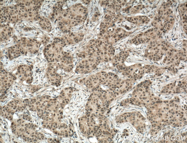 TBP Antibody in Immunohistochemistry (Paraffin) (IHC (P))