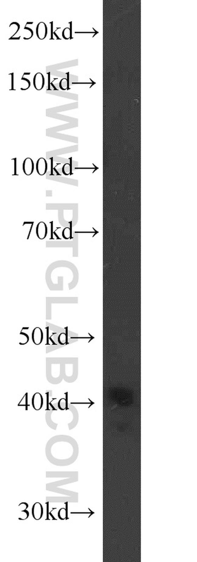 TBP Antibody in Western Blot (WB)