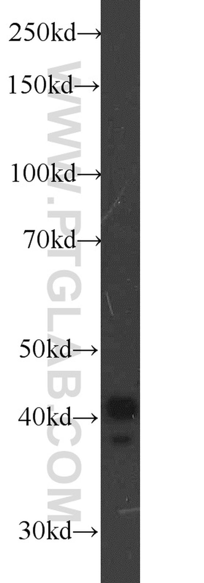 TBP Antibody in Western Blot (WB)