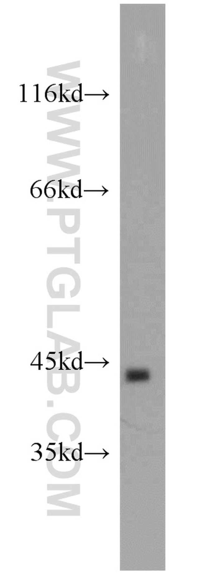 TBP Antibody in Western Blot (WB)