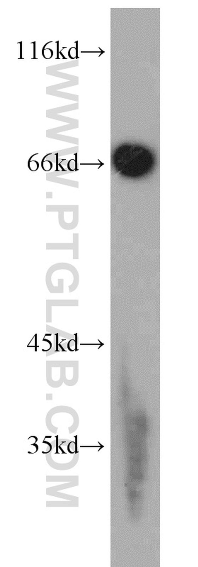 EGR1 Antibody in Western Blot (WB)