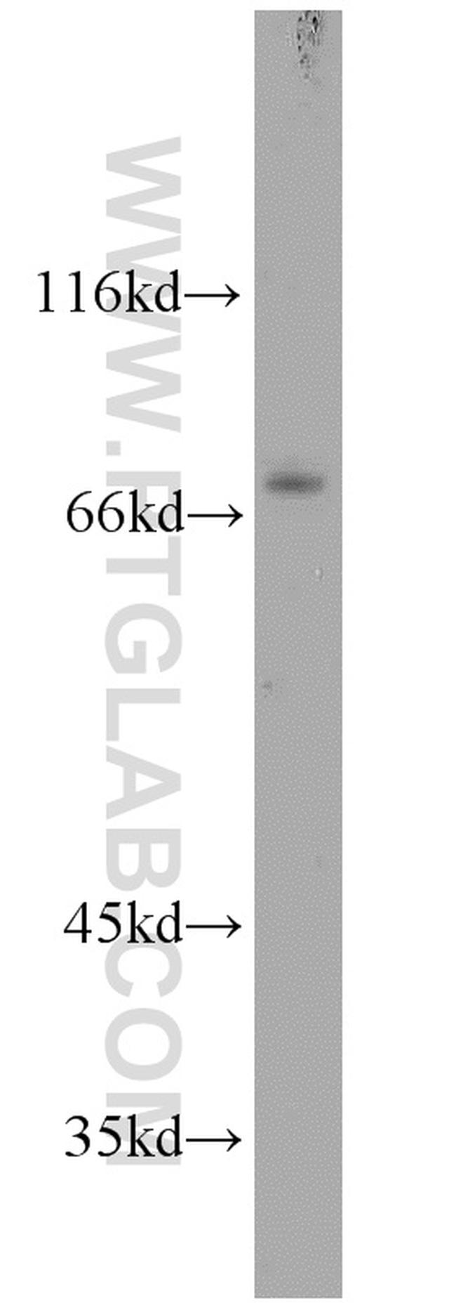 EGR1 Antibody in Western Blot (WB)