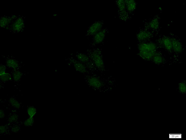 SAMD14 Antibody in Immunocytochemistry (ICC/IF)