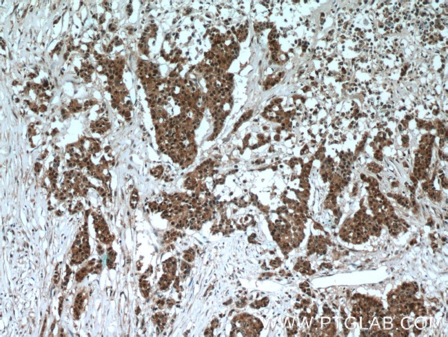 SAMD14 Antibody in Immunohistochemistry (Paraffin) (IHC (P))