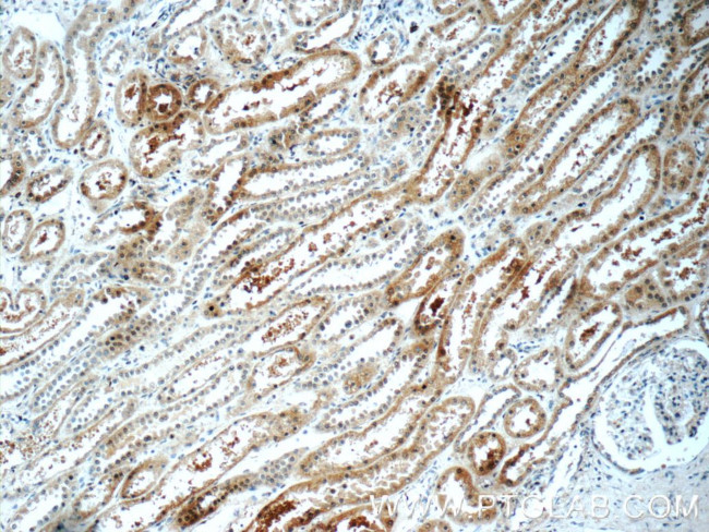 SAMD14 Antibody in Immunohistochemistry (Paraffin) (IHC (P))