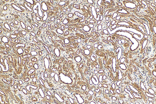 SAMD14 Antibody in Immunohistochemistry (Paraffin) (IHC (P))