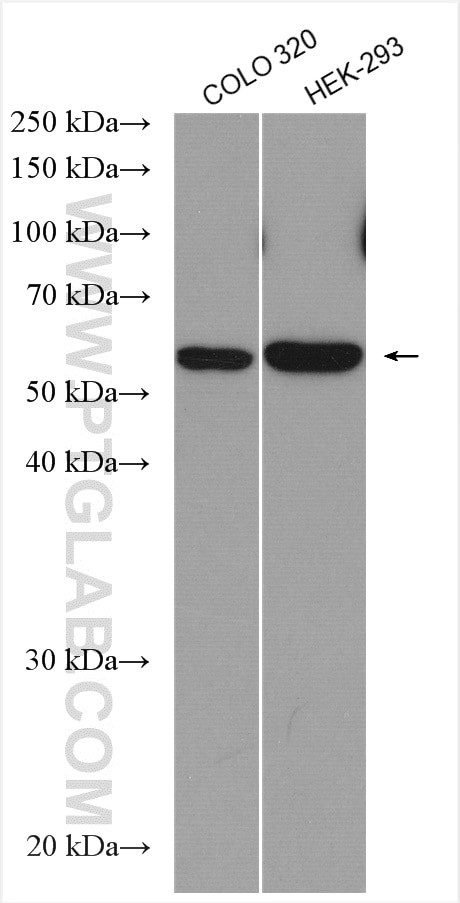 SAMD14 Antibody in Western Blot (WB)