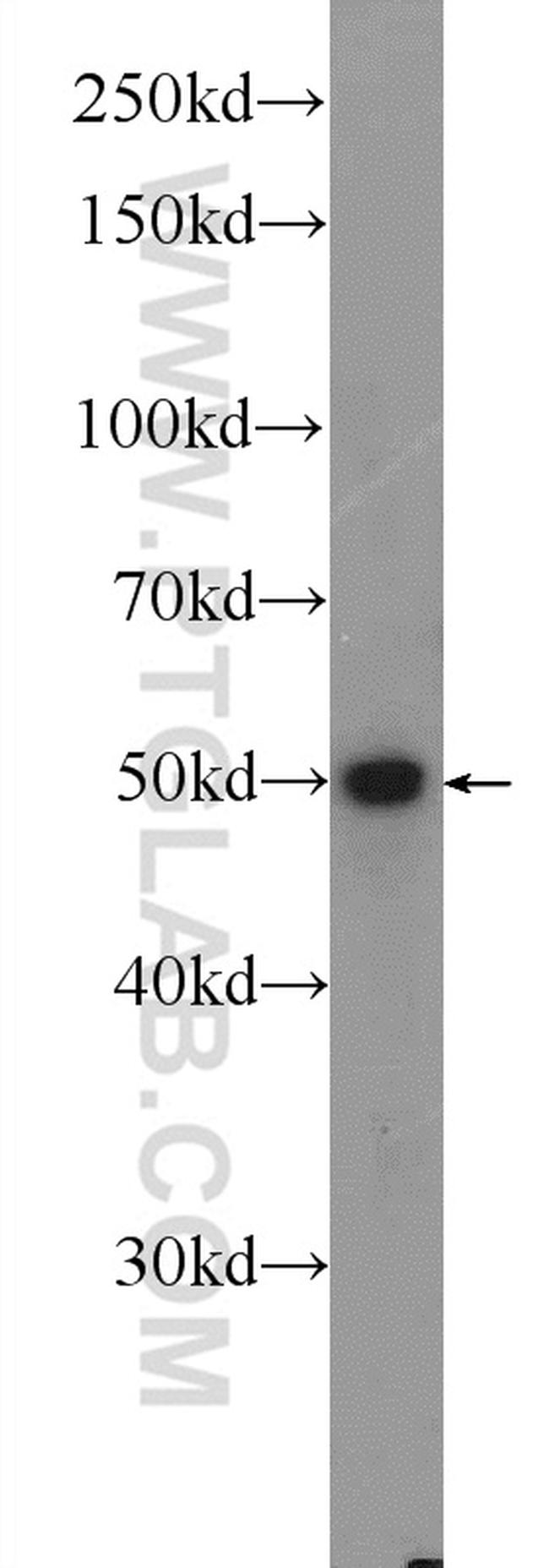 SAMD14 Antibody in Western Blot (WB)