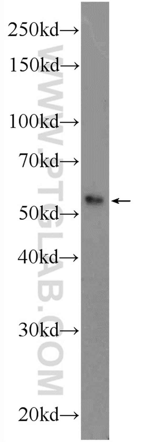 SAMD14 Antibody in Western Blot (WB)