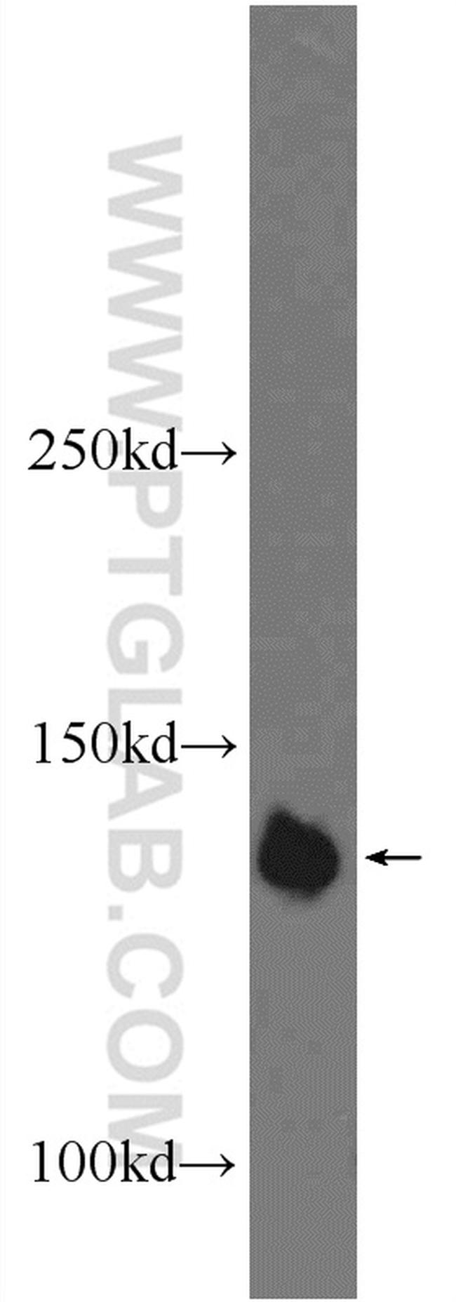 PHF20 Antibody in Western Blot (WB)