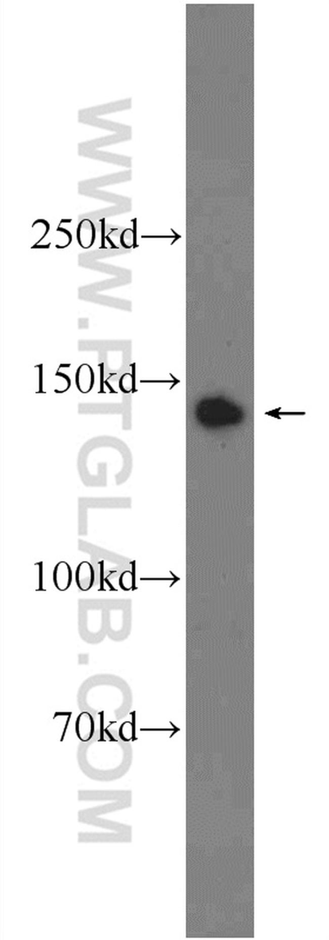 PHF20 Antibody in Western Blot (WB)