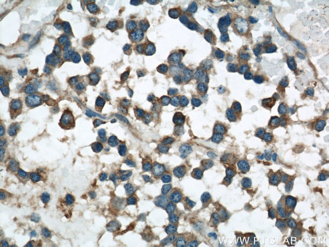 VAT1 Antibody in Immunohistochemistry (Paraffin) (IHC (P))