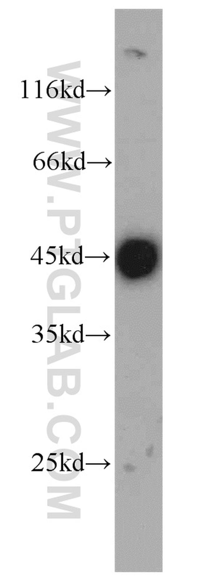 VAT1 Antibody in Western Blot (WB)