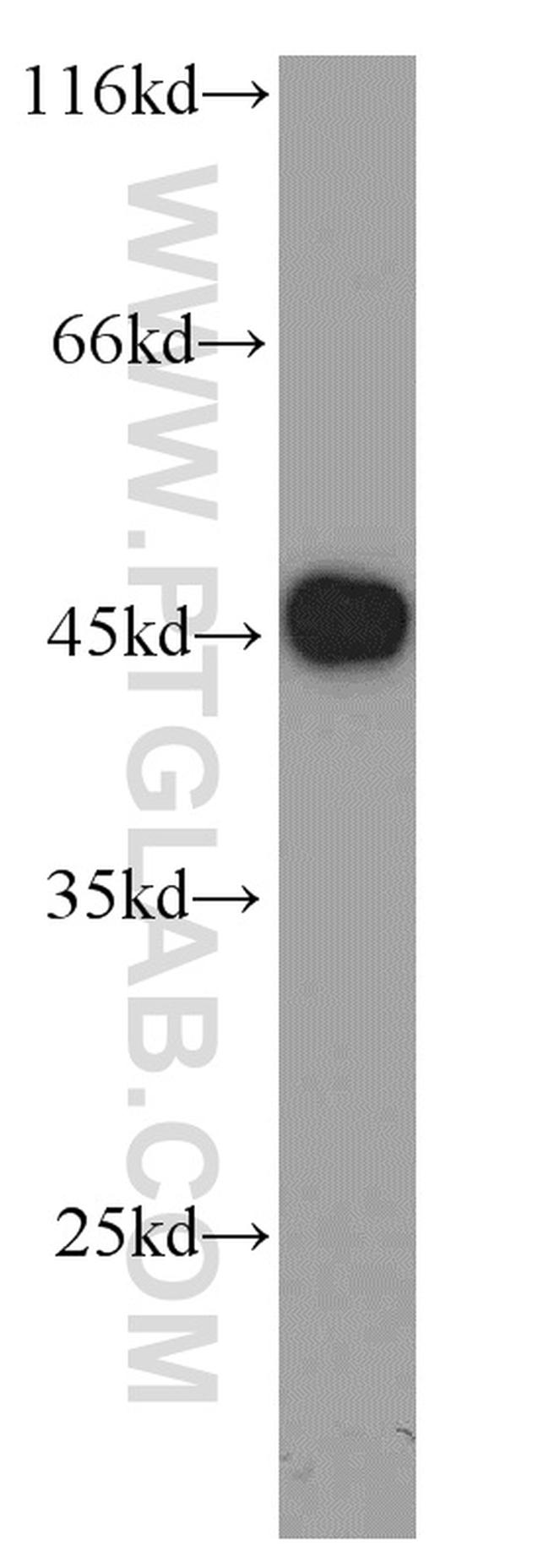 VAT1 Antibody in Western Blot (WB)