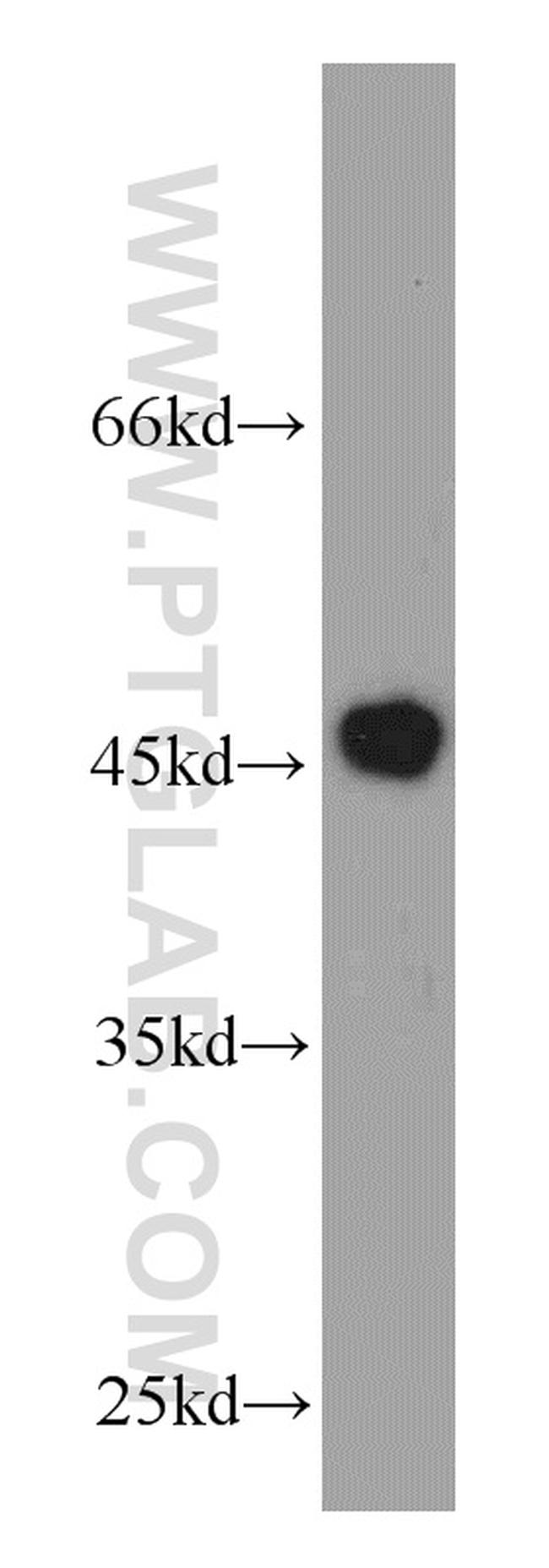 VAT1 Antibody in Western Blot (WB)