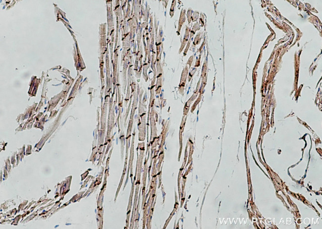 N-cadherin Antibody in Immunohistochemistry (Paraffin) (IHC (P))