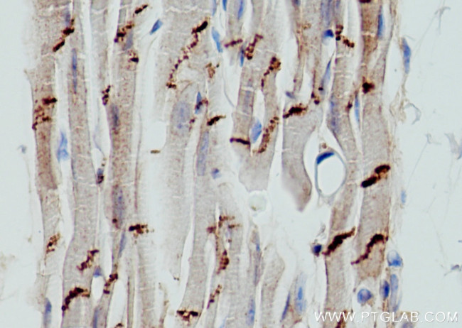 N-cadherin Antibody in Immunohistochemistry (Paraffin) (IHC (P))