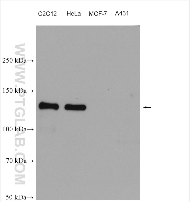 N-cadherin Antibody in Western Blot (WB)