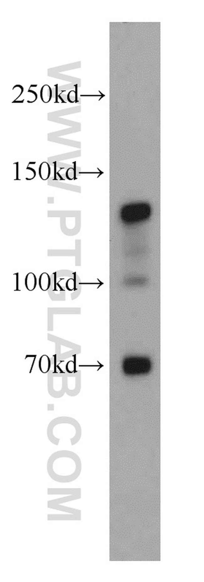 N-cadherin Antibody in Western Blot (WB)