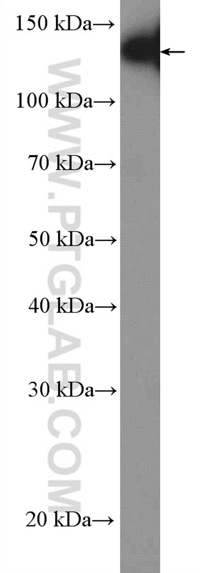 N-cadherin Antibody in Western Blot (WB)