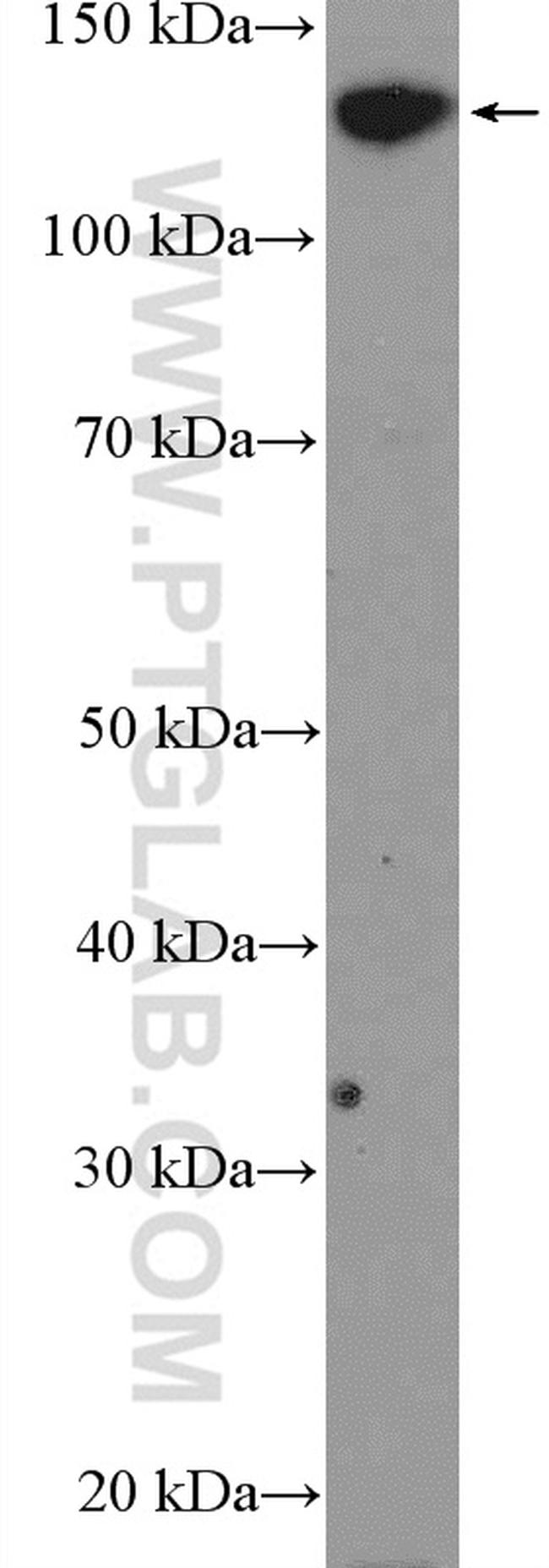 N-cadherin Antibody in Western Blot (WB)