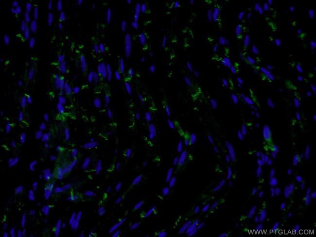 N-cadherin Antibody in Immunohistochemistry (PFA fixed) (IHC (PFA))