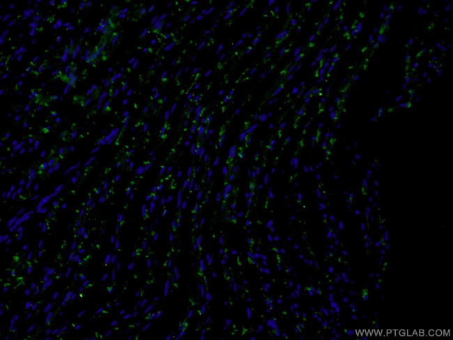 N-cadherin Antibody in Immunohistochemistry (PFA fixed) (IHC (PFA))