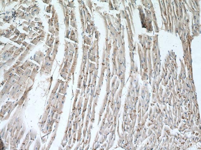 N-cadherin Antibody in Immunohistochemistry (Paraffin) (IHC (P))