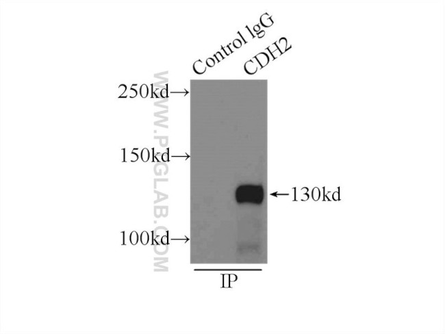 N-cadherin Antibody in Immunoprecipitation (IP)