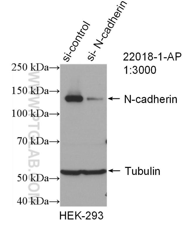 N-cadherin Antibody in Western Blot (WB)