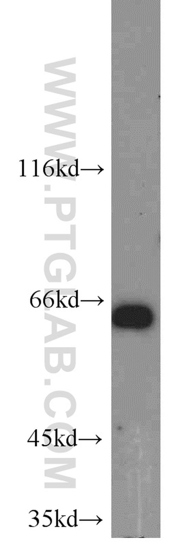 TERF2 Antibody in Western Blot (WB)