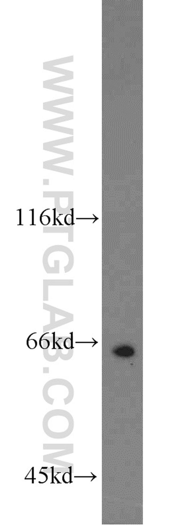 TERF2 Antibody in Western Blot (WB)