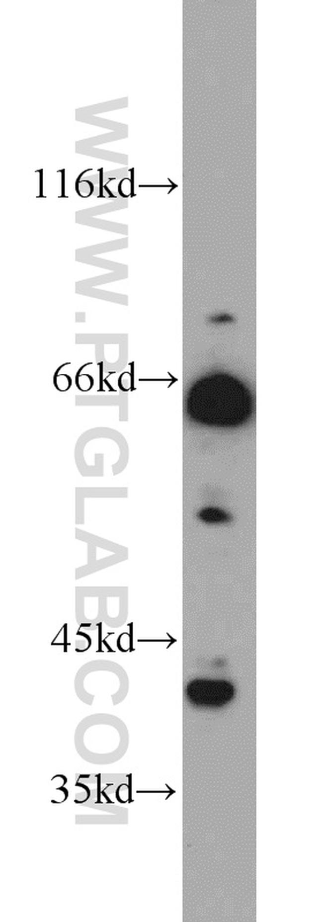 TERF2 Antibody in Western Blot (WB)