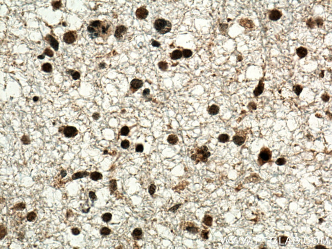 TERF2 Antibody in Immunohistochemistry (Paraffin) (IHC (P))