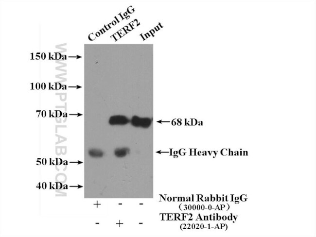 TERF2 Antibody in Immunoprecipitation (IP)