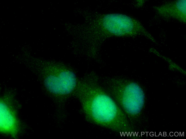 NFATC2 Antibody in Immunocytochemistry (ICC/IF)