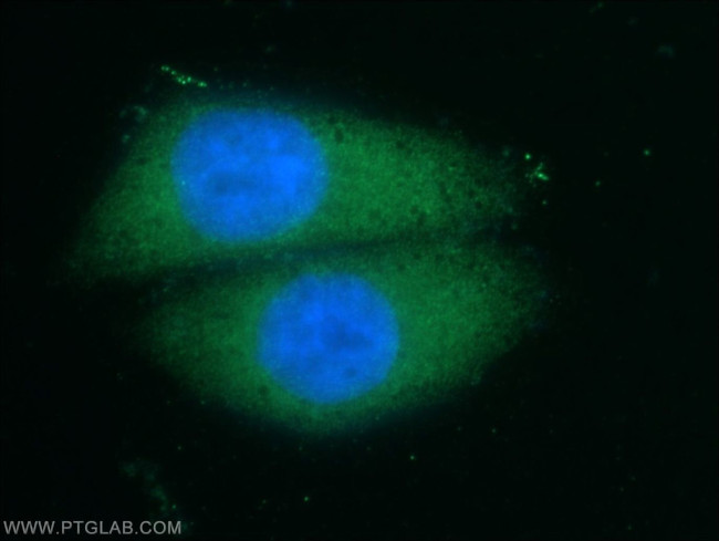 NFATC2 Antibody in Immunocytochemistry (ICC/IF)